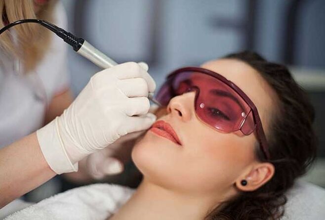 Biorevitisation laser