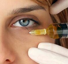 Rajeunissement de l'injection des paupières
