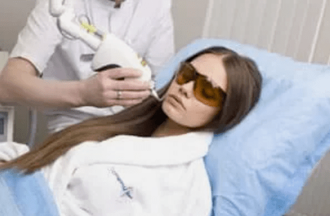 rajeunissement fractionné au laser