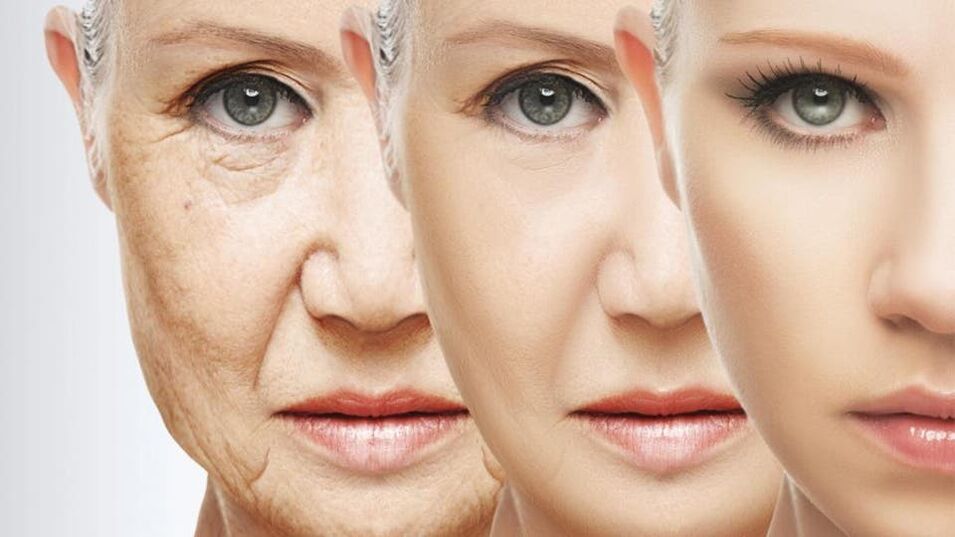 Rajeunissement fractionnaire de la peau si nécessaire