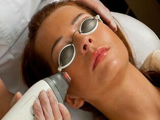 rajeunissement du visage au laser