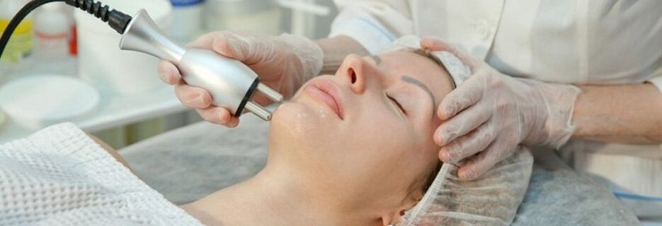 Procédure de rajeunissement fractionné de la peau du visage au laser